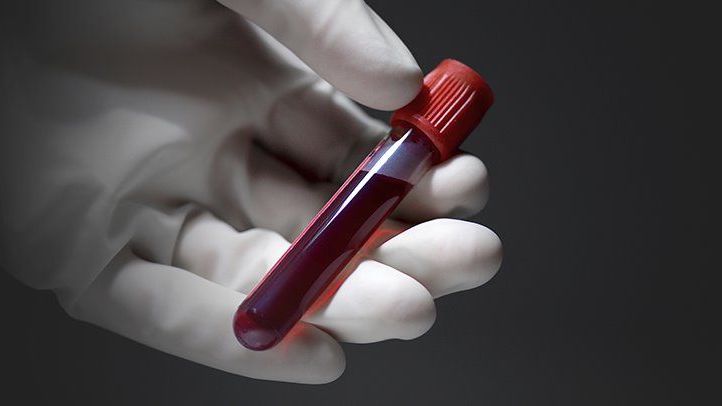 Provetta con sangue per test allergologici